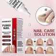 thumbnail image 4 of 15ml Fungi Nail Treatment Liquid Fast-acting Nail Repair Strengthening Liquid Nails Care Supplies 25-26, 4 of 5
