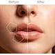 thumbnail image 3 of Facial Hair Removal for Women, Painless Hair Removal Device, Portable Facial Hair Remover for Face with USB Rechargeable 1 shaver, 3 of 4