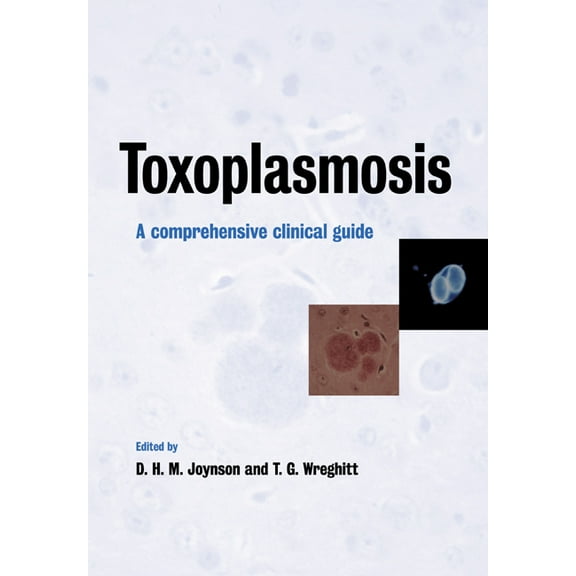 Toxoplasmosis: A Comprehensive Clinical Guide, (Paperback)