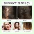 thumbnail image 5 of 2pcs Rosemary thickening shampoo, plant-based oil control, fluffy, long-lasting, refreshing, not flat, repair frizzy hair, plump and strong, suitable for both men and women, 5 of 8