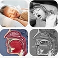 thumbnail image 2 of Corrección de respiración cerrada Corrección de respiración bucal Niños durmiendo Corrección de respiración bucal abierta Pasta para callarse, 2 of 4