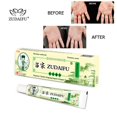 thumbnail image 3 of ZUDAIFU Crema a base de hierbas Psoriasis Antibacteriano Dermatiti Eczematoid Cuidado de la piel Ndcxsfigh Nuevos Originales, 3 of 9
