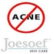 Sulfur Soap Dermatologist Approved 60 years | Joesoef Skin Care Sulfur Soap