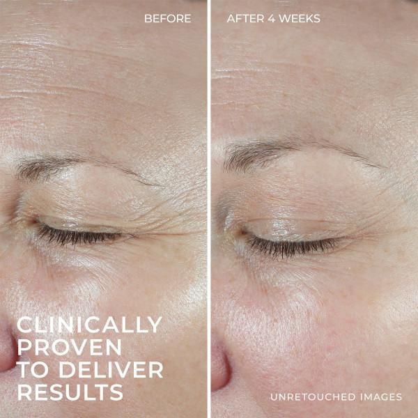 RoC Skincare - Hydratation + Moisturizer®️ - + Acide Hyaluronique + Protéine de Collagène - 48gm RoC Skincare