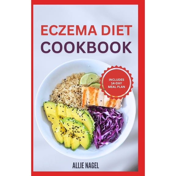 Eczema Diet Cookbook: Delicious Anti-Inflammatory Gluten-Free Recipes and Meal Plan to Detoxify, Manage Inflammation, Flare Ups & Itches (Paperback)