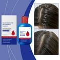 thumbnail image 4 of cuyhtdup Selenium Disulfide Oil Control Shampoo Oil Dandruff Itching Hair Care Shampoo Oil Control Refreshing Oppose-Dandruff Cleansing For Men And Women, 4 of 7