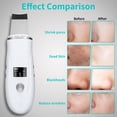 thumbnail image 4 of Skin Scrubber Face Spatula - Deep Cleansing Tool for Pore Extraction, Fast Charging Dock Blackhead Remover Face Spatula,1 * Skin Scrubber Face Spatula 2 * silicone tips 1 * USB cable,White, 4 of 7