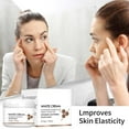 Triamcinolone Acetonide Cream: Dark Spot Miracle? - qkudf3t