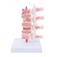thumbnail image 1 of Modelo profesional de osteoporosis, modelo anatómico de columna vertebral humana para demostración didáctica., 1 of 14
