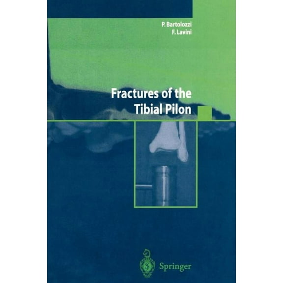 Fractures of the Tibial Pilon, (Paperback)