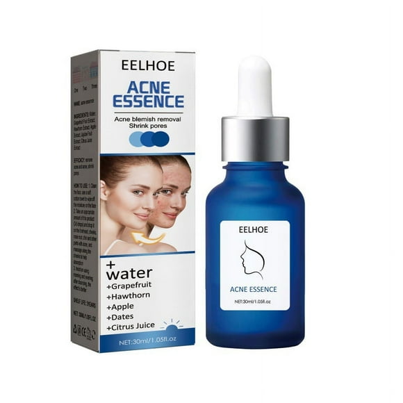 Small Blue Bottle Acne Treatment Serum Fades Acne Marks and Gently Repairs 30ml