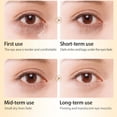 thumbnail image 4 of Anti Wrinkle Whitening Eye Cream Skin Care Horse Oil Cream 2021 Anti Wrinkle Whitening Eye Cream Skin Care Horse Oil Cream Anti Aging Anti Wrinkles Face Cream Eye Essence Remove ANGGREK Anti Wrinkle Whitening Eye Cream, 4 of 8
