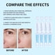 thumbnail image 4 of Crema facial con ácido hialurónico esencial que reduce los poros, hidrata la piel, equilibra la grasa y rejuvenece la piel. 36 ml., 4 of 5