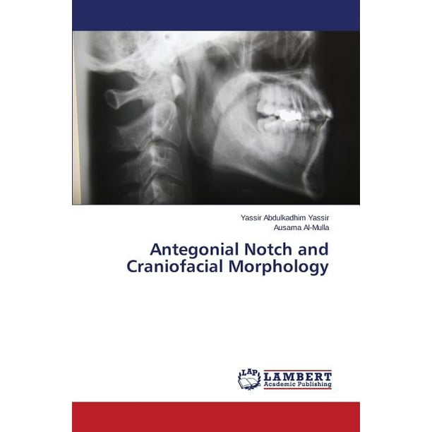 Antegonial Notch and Craniofacial Morphology
