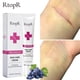 thumbnail image 1 of Crema para eliminar el acné y las marcas de acné, extracto de hierbas, eficaz, antiinflamatoria, reparación de la piel, control de la grasa hidratante"Buy 10 get 12 free" Fivean LED, 1 of 2