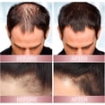 thumbnail image 2 of Cuidado personal, Productos para el cuidado del cabello, Productos para el cuidado del cabello, Spray para la caída del cabello, Spray para el cuidado del cabello, Spray espesante para cabello fino, E, 2 of 4