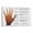 FRAMED12X18INCH(30X45CM), variant on Skin Color Warning Signs Poster Health Signal Hospital Wall Art (2) Canvas Painting Wall Art