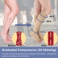 thumbnail image 4 of Medias de compresión médicas con banda de silicona, medias de compresión hasta la rodilla con punta abierta y soporte graduado firme de 20 a 30 mmHg, 4 of 4