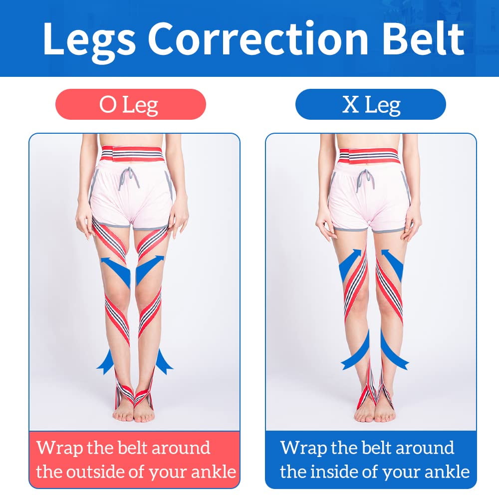 O / X Legs Correction Belt Legs Posture Corrector Band Unisex O / X Legs Type Legs Bandage Lightweight Pediatric Straighten Belt for Men Women and Children for Day and Night (M)