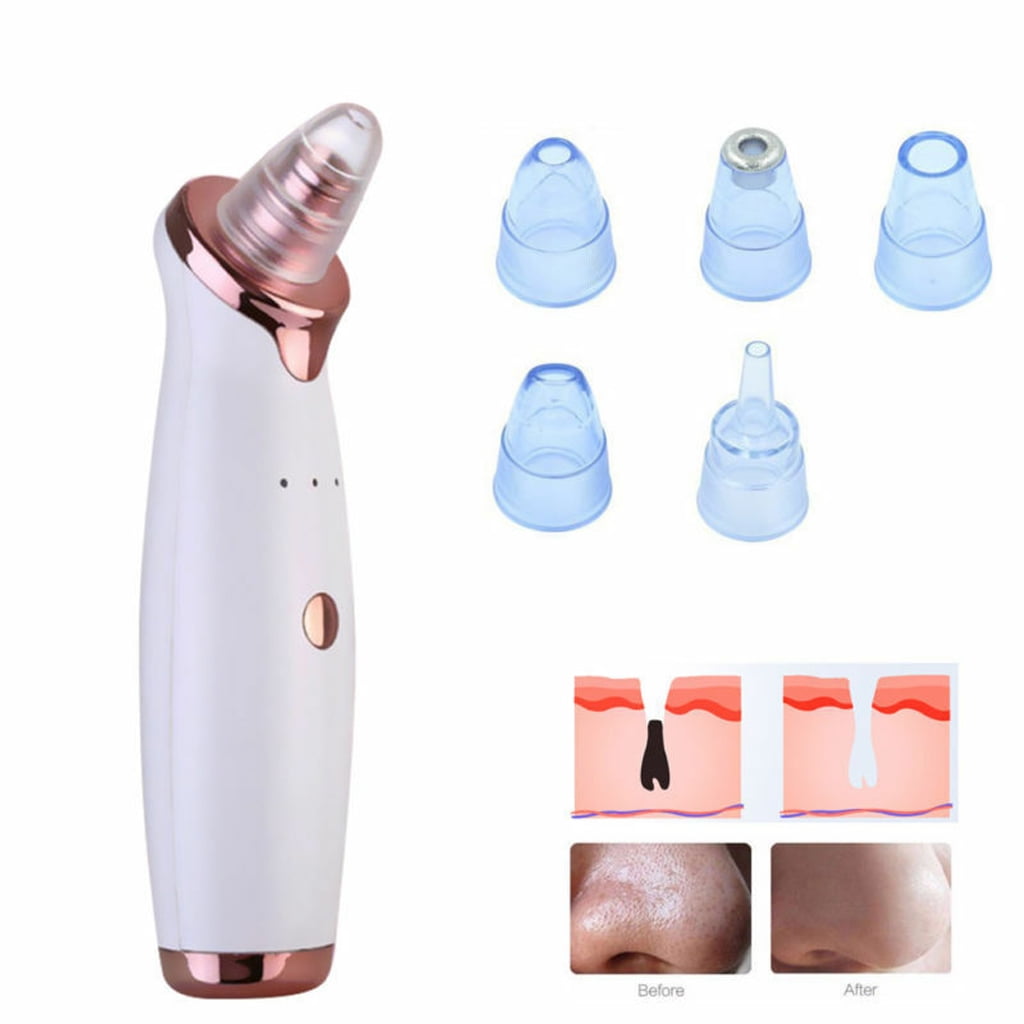 blackhead extractor blackhead extractor