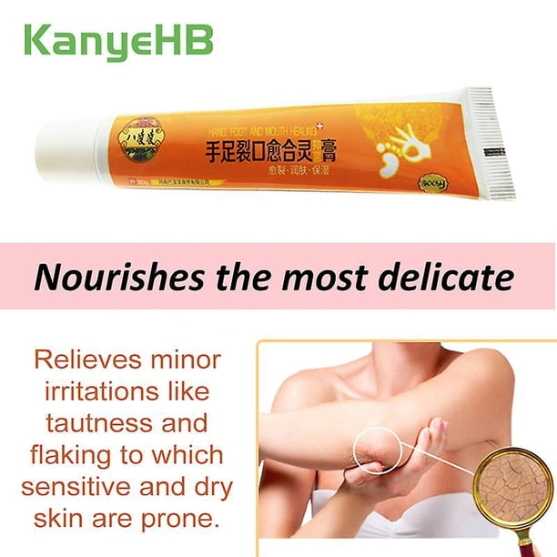Ungüento para eliminar la piel muerta de los pies, producto para el cuidado de la piel, crema para grietas antisecado, fuerte y eficaz, crema para talón de manos S012//, 1 Uds. kaili Sencillez