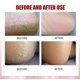 thumbnail image 2 of Foot Cream Anti-freeze, Anti-dry, Moisturizing, Repairing, Dry, Peeling, Rough, Cracked Cream, 2 of 5