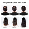 thumbnail image 4 of Champú Growth Essence con minoxidil y biotina con cafeína y ricino, 4 of 9