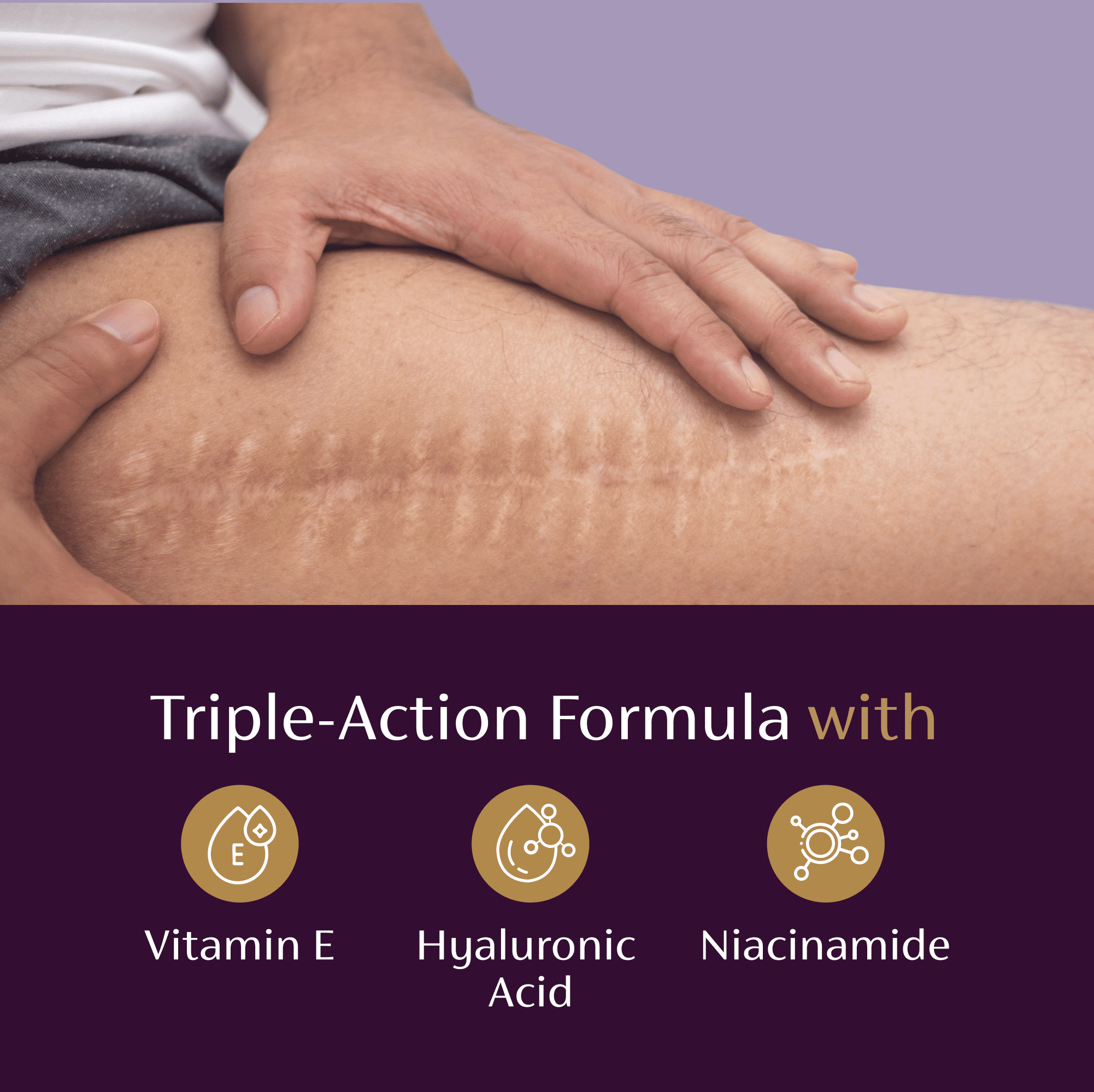 (3 pack) Mederma Scar Serum – Triple-Action Formula with Vitamin E, Hyaluronic Acid & Niacinamide – Clinically Shown to Reduce Old Scars,  1 Fl. Oz.