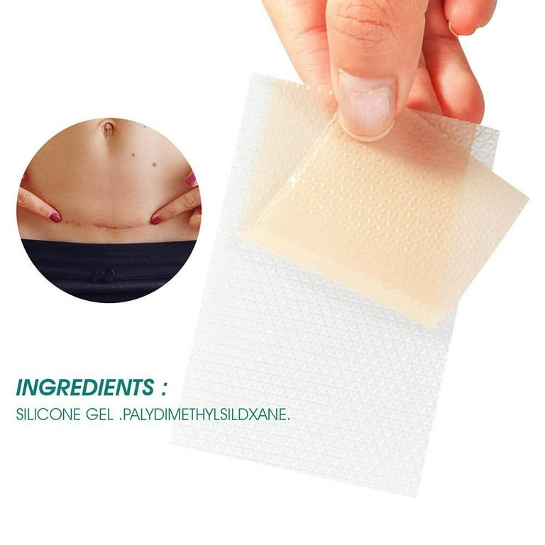 Scar sale gel pads