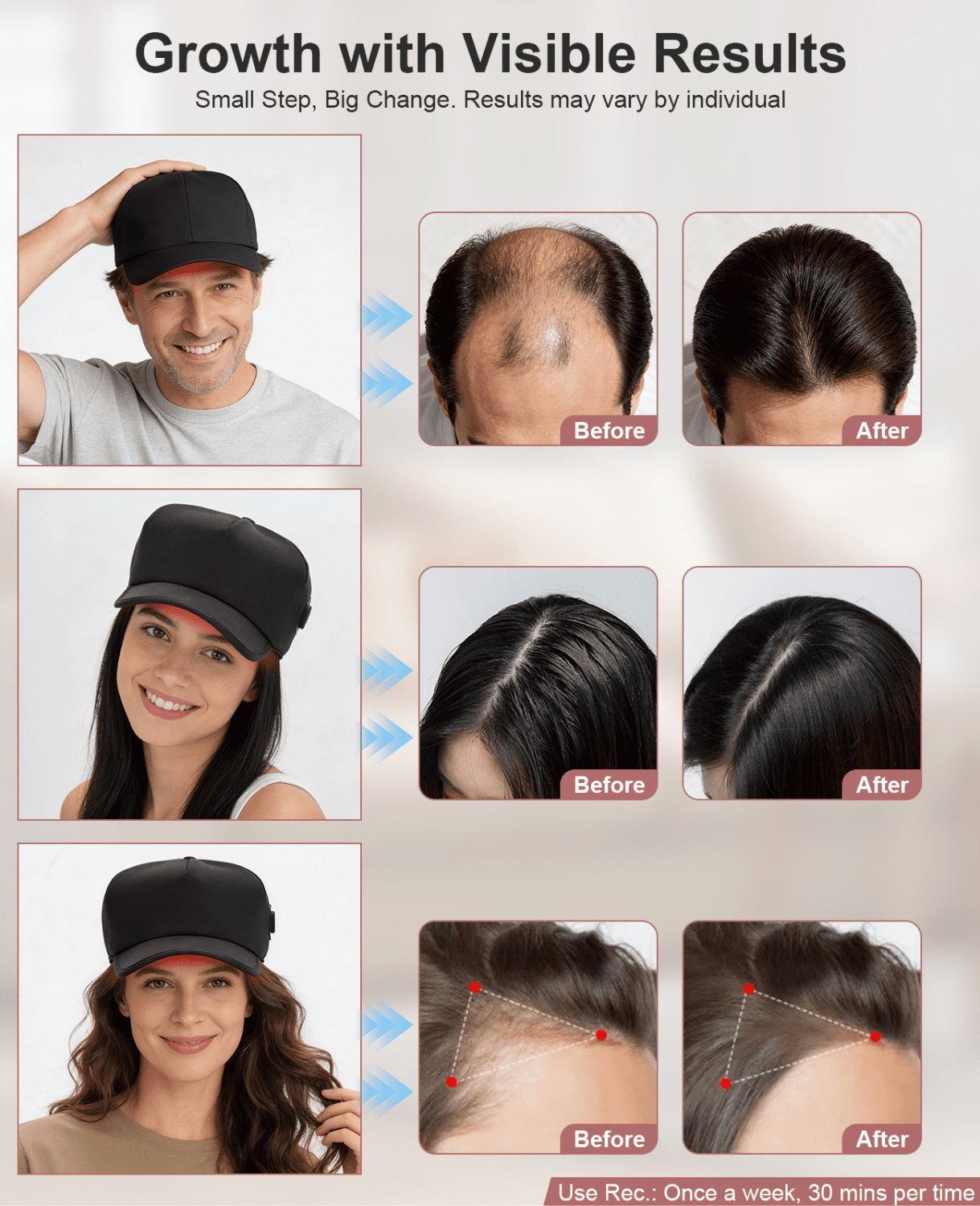 Head Massager LED Cap with 540 Medical Grade LEDs - 6 Modes & Adjustable Fit 22-27 - Rechargeable Red Light Cap for Scalp Health - Wireless Travel-Friendly