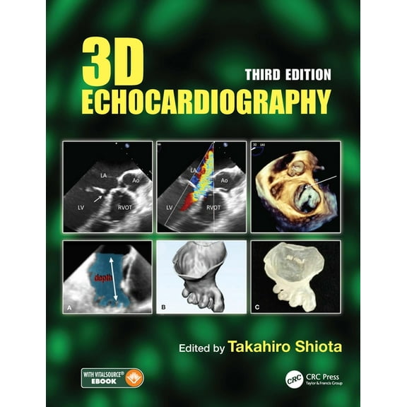 3D Echocardiography, (Hardcover)