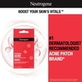 Neutrogena Stubborn Acne Hydrocolloid Acne Treatment Patch, 24 ct