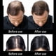 thumbnail image 2 of 10 Colors Thickening Hair Fiber Powder 50g Hair Fibers Building Extensions Powder Hair Loss Concealers, 2 of 5
