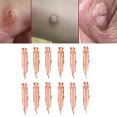 thumbnail image 4 of Skin Tag Removal Clip Skin Tag Remover Tool Skin Mole Wart Remover Skin Tag Remover Clips Safe Copper Smooth Skin Tag Removal Tool For Face Neck Body12 Pcs ANGGREK 12 piezas, 4 of 8