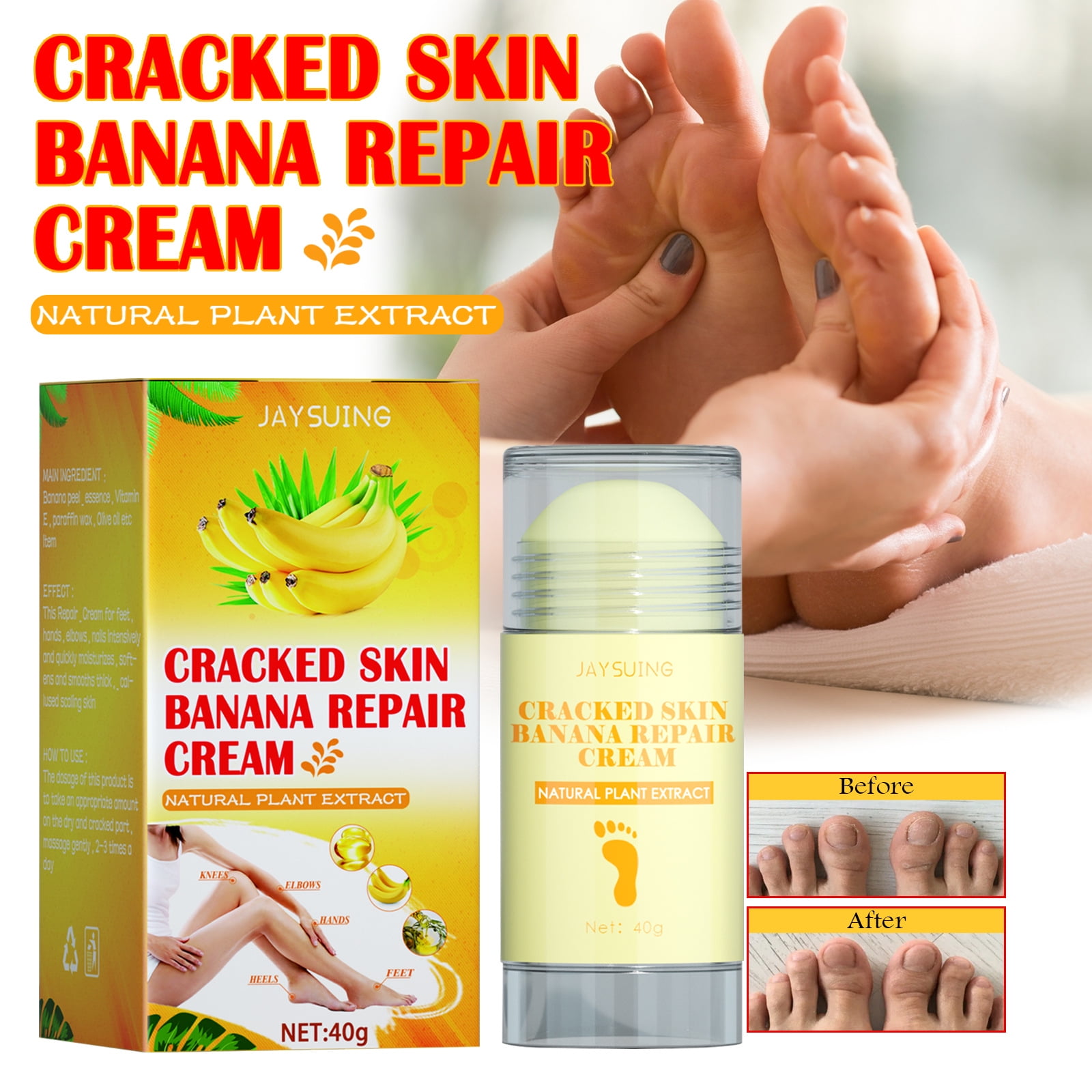 Cracked Heel Repair Balm 40g, for Dry Cracked Feet, Heals and