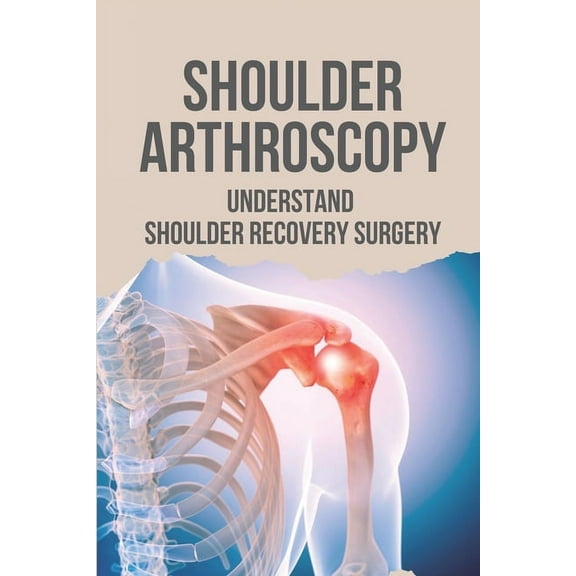 Shoulder Arthroscopy: Understand Shoulder Recovery Surgery: Shoulder Surgery Rehibilitation
