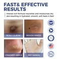 thumbnail image 6 of OUKEYA Urea Cream 42% + Salicylic Acid 2% Repair Moisturizer for Dry Hands, Heels, Elbows , 5.29 oz, 6 of 7
