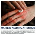 thumbnail image 3 of 1/2/3Pcs 30g Chilblain Cream Anti-cracking Frostbite Moisturiser Deep Nourishing, 3 of 5