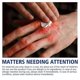 thumbnail image 3 of 1/2/3Pcs 30g Chilblain Cream Anti-cracking Frostbite Moisturiser Deep Nourishing, 3 of 5