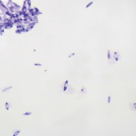 Clostridium Botulinum, W.M. Microscope Slide