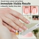 thumbnail image 3 of Kit de manicura y pedicura LePinko Diamond, lima de uñas con abrillantador, 3 of 7