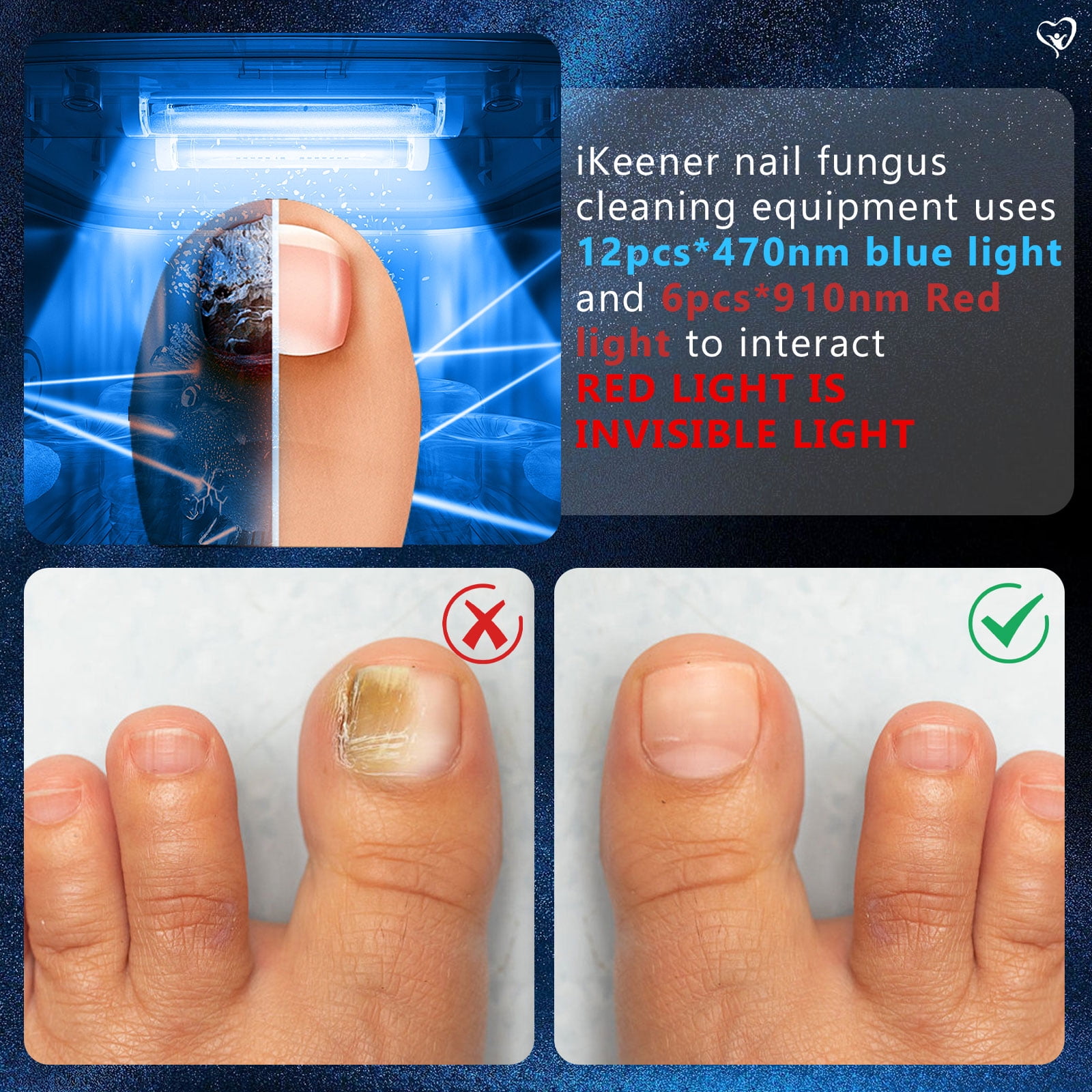 Nail Fungus Cleaning Light Therapy Device – Adjustable 3, 5, 10 Minute Sessions – Treat Multiple Fingers & Toes-12pcs 470nm & 6pcs 910nm for Home Use Treat and Highly Effectively Prevent