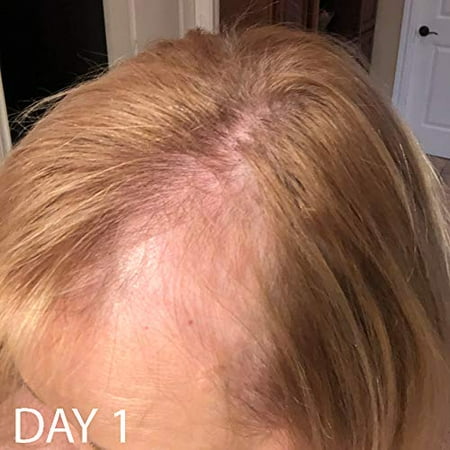 Biotin Hair Growth Shampoo Biotin Vitamin Shampoo For Hair Loss