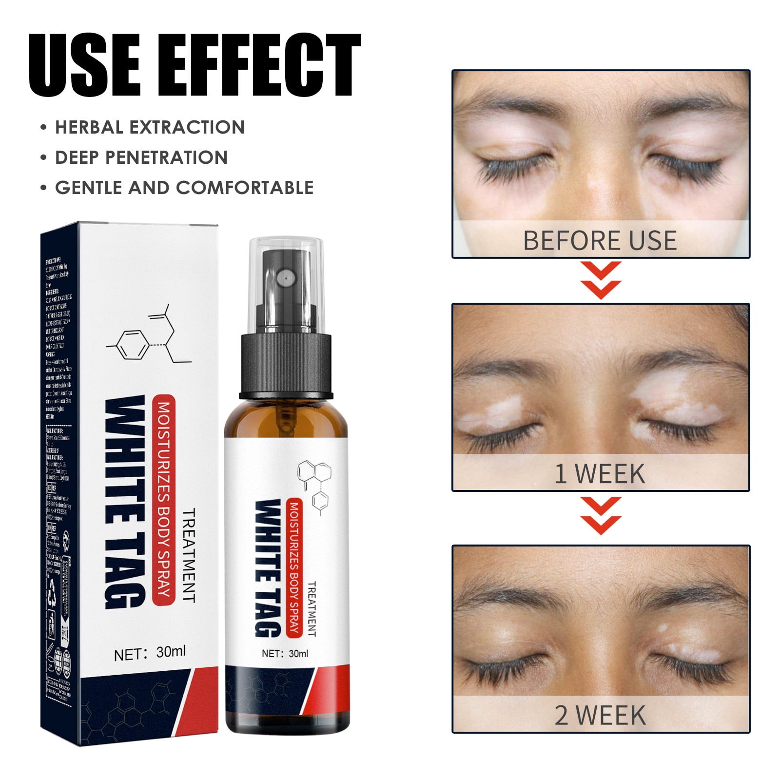 Alvantor Skin Repair Spray Moisturizing Body Treatment for Uneven Skin Tone, 1.01fl.oz