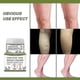 thumbnail image 2 of Varicose Veins Cream, Effective Varicose And Spider Veins Treatment, 2 of 4