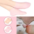 thumbnail image 3 of Calcetines para el cuidado de pies y manos Guantes Protector de gel de silicona Exfoliante Hidratante Antisequedad Antigrietas Eliminación de piel muerta Herramientas para pies, 3 of 6