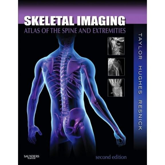 Skeletal Imaging: Atlas of the Spine and Extremities, (Hardcover)