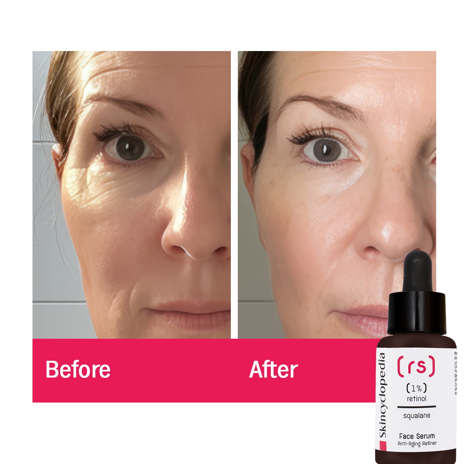 Skincyclopedia Retinol & Squalane Face Treatment, Facial Serum, Under Eye Roll-On & Hydrogel Patches, Energizing Serum for Dark Circles, Puffiness Bags, Fine Lines & Wrinkles, Firms & Brightens Skin.