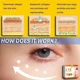 thumbnail image 4 of Crema antiarrugas para ojos, elimina bolsas, hinchazón, ojeras debajo de los ojos, aclaramiento de líneas finas, blanqueamiento hidratante, cuidado de la piel, 4 of 5
