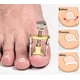 thumbnail image 5 of Herramienta de corrección levantadora de uñas encarnadas, tratamiento de paroniquia, Corrector de restauración de uñas de los pies, herramienta de pedicura para el cuidado del pie, 5 of 6